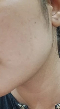 After