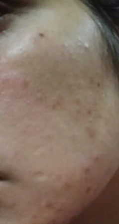 Before